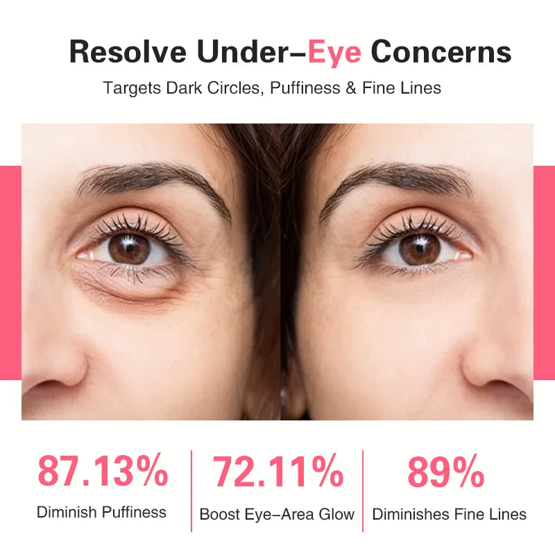 Fast Acting PDRN Retinol Eye Patch Reduce Wrinkles in 15min for Dark Circle Relief G