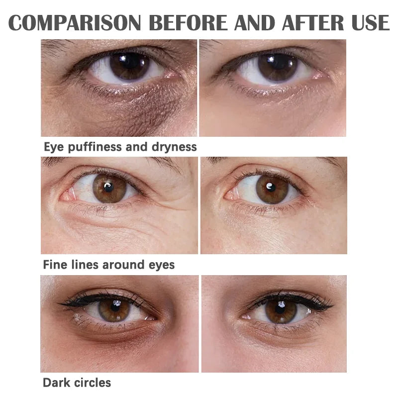 Hydrolyzed Collagen Under-Eye Sheet Patches with Panthenol, 30 Pairs - image 6