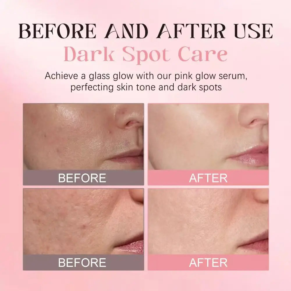 Premium Korean PDRN Pink Peptide Serum - 30ML Anti-Aging Facial Treatment for Deep
