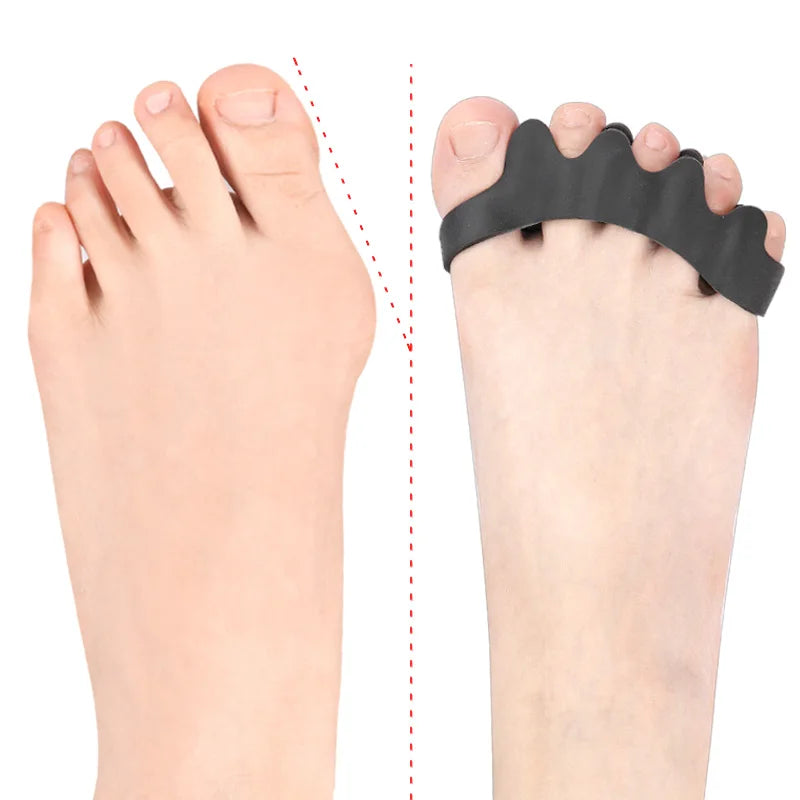 Silicone Toe Separators for Overlapping Toes, Size S or L - image 4